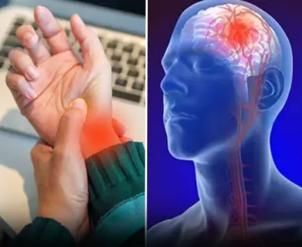 Recognizing Mini-Stroke Symptoms: A Crucial Step in Stroke Prevention