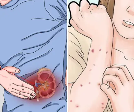 Early Signs of Kidney Disease & How to Protect Your Kidneys (Evidence Based)