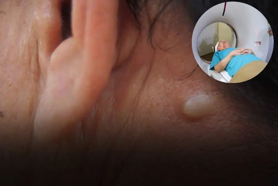 5 Early Signs of Thyroid Can.cer That Are Easy to Recognize