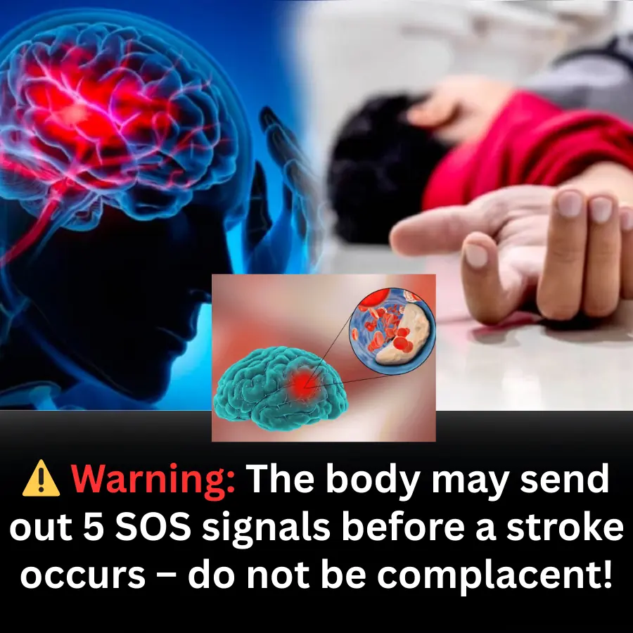 Doctors Warn: 5 Warning Signs the Body May Send Before a Stroke