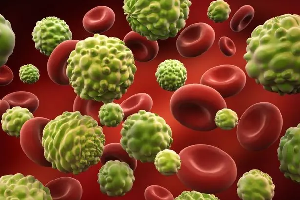 Can.cer often sends quiet signals in the morning - 3 symptoms you should never ignore