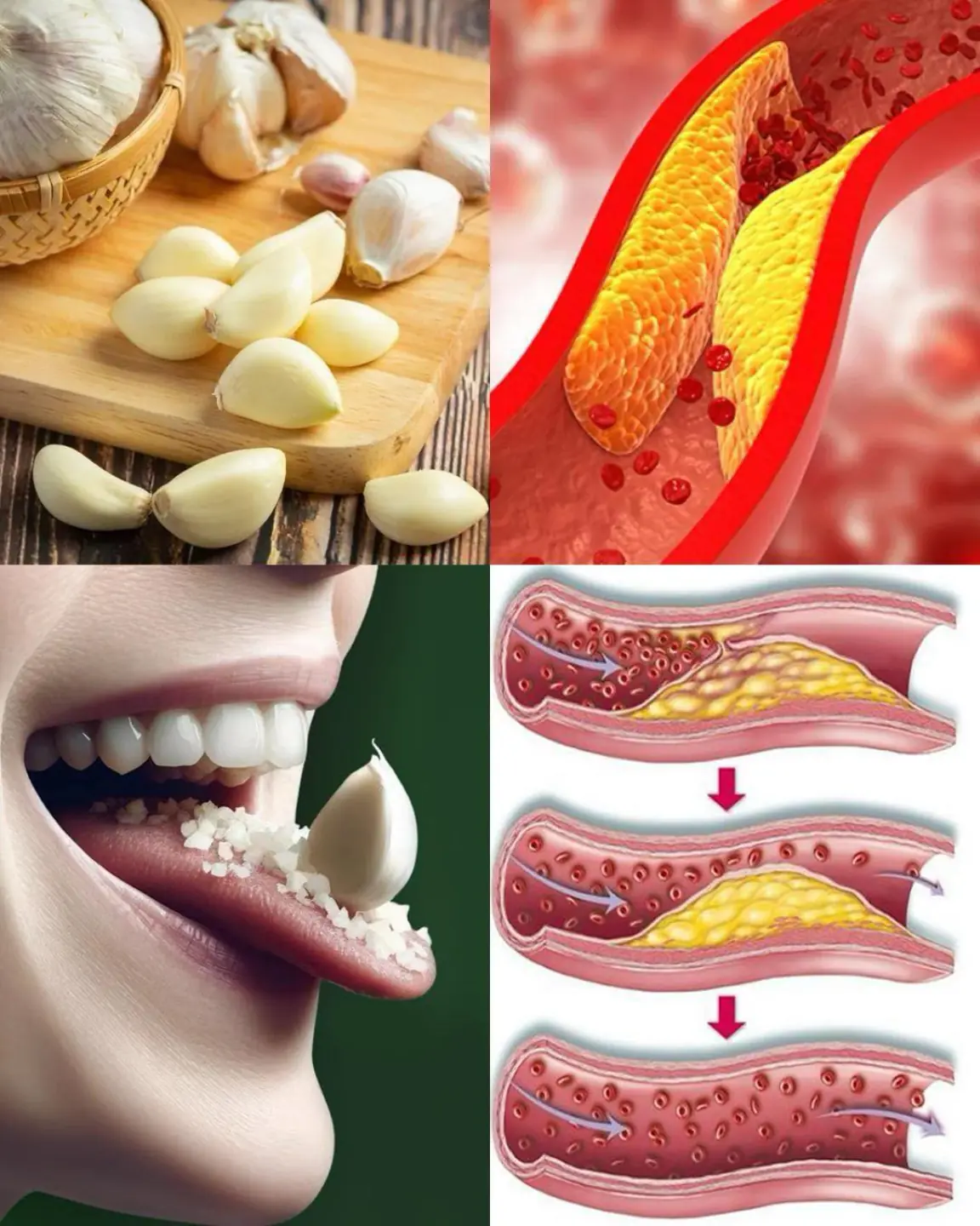 Eating raw garlic every day: A natural way to support cardiovascular health and lower cholesterol