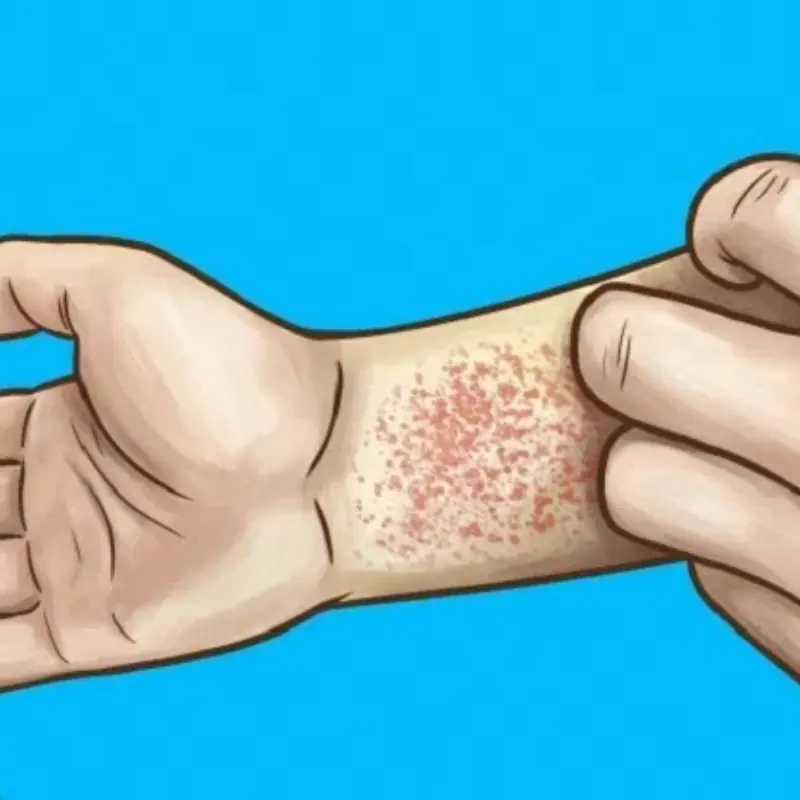 10 Signs That Your Kid.neys Are Weakening and Need Medical Attention