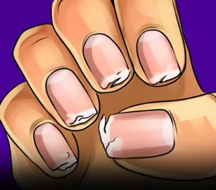 You Should Never Ignore These 9 Things Your Fingernails Reveal About Your Health