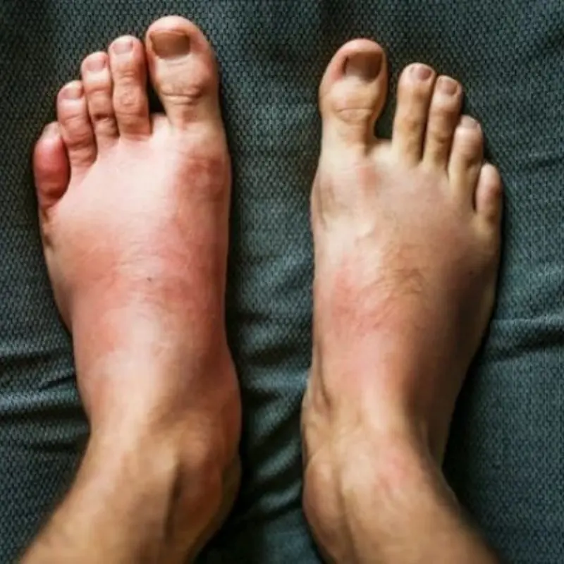 Don’t Ignore These 7 Early Heart Attack Warning Signs