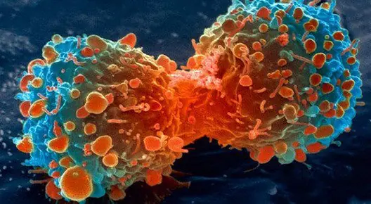 Three Principles to Prevent Can,cer Cells — Everyone Should Act Now to Say No to the Disease