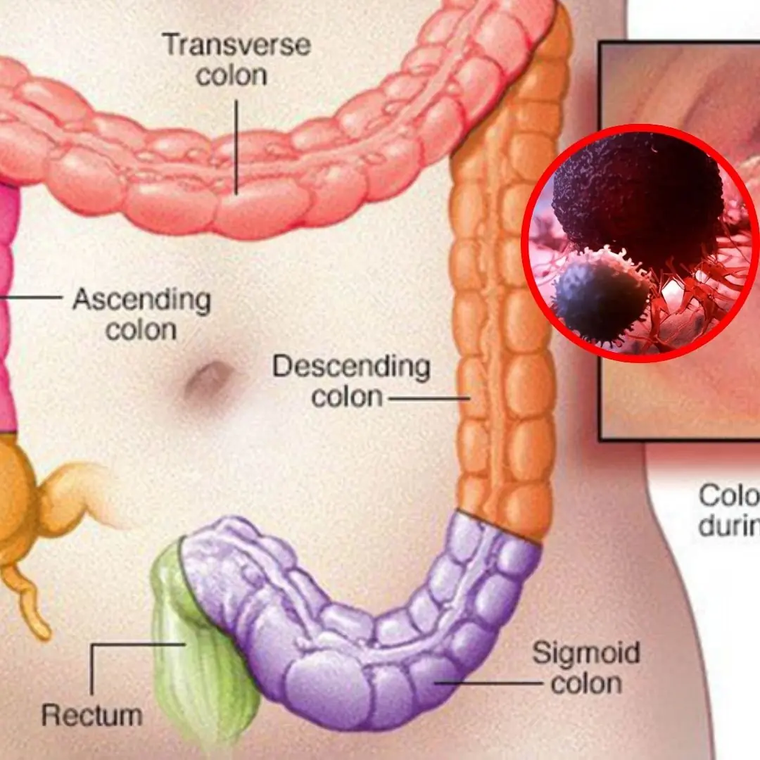 8 Bathroom Signs That Could Signal a Serious Problem