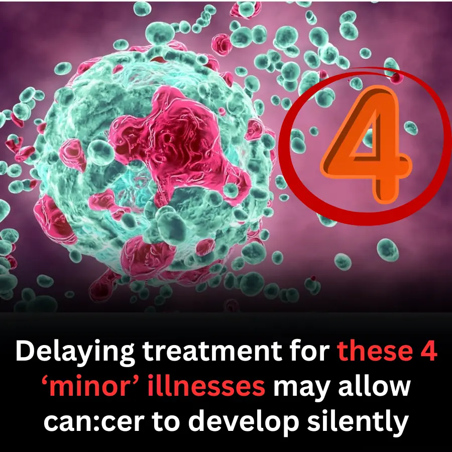 Doctors Warn: Ignoring “Mild” Conditions Can Have Serious Consequences
