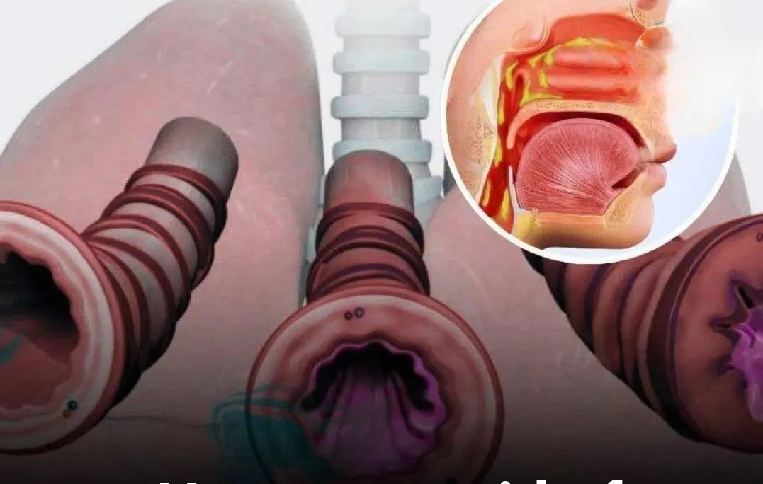 Thankfully, there are several things you can do at home to help clear mucus and breathe easier