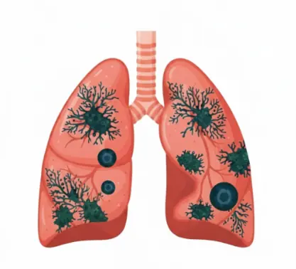 5 Signs Your Lungs are Being Exposed to Mold