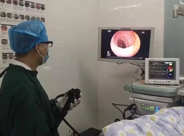 People with Colorectal Can.cer Often Share 4 Habits — Hopefully You Don’t Have Any of Them