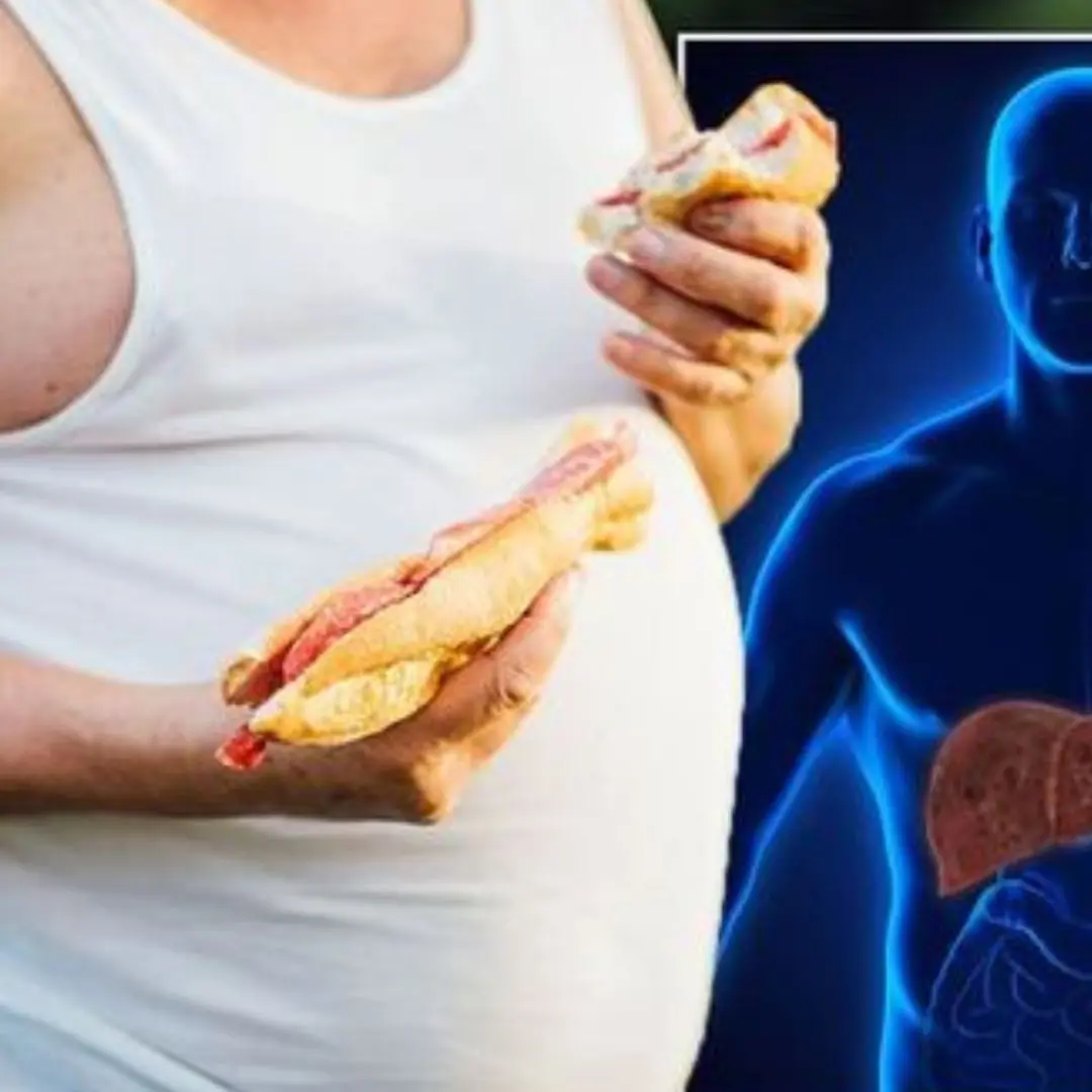 Fatty liver disease diet: Crucial foods you should avoid to slash your risk of symptoms