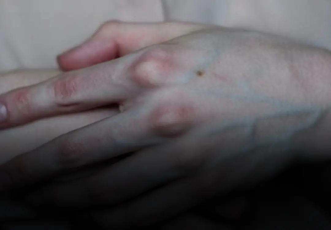 If You Notice Someone With Visible Veins, You Should Tell Them These Things