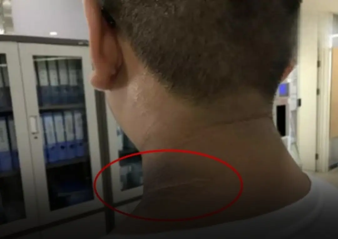 Be Careful With Diabetes If You Often Experience These Signs