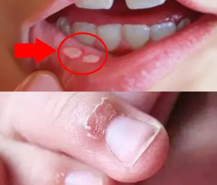 8 Early Warning Signs of Nutrient Deficiency Written All over Your Body