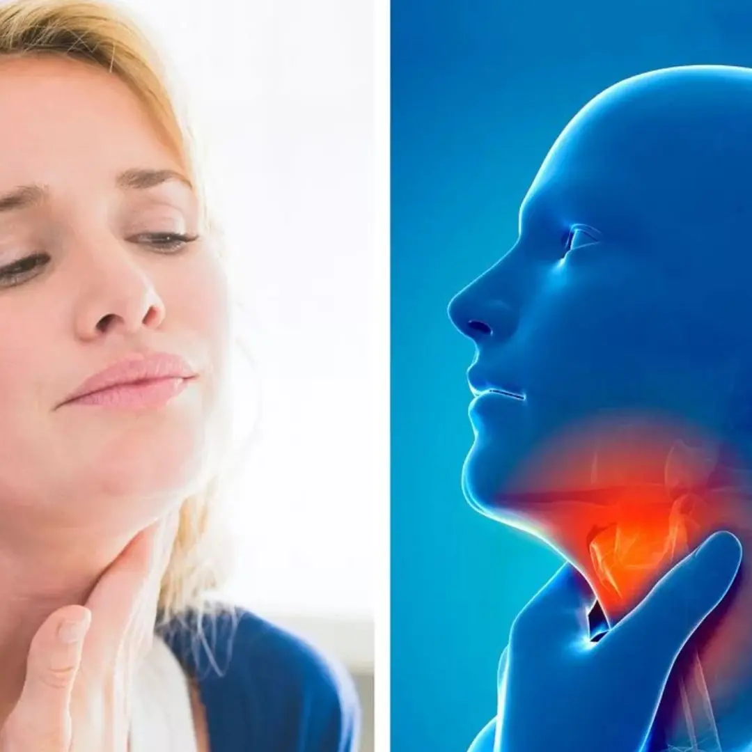 What's the difference between strep throat and sore throat? Full symptoms explained