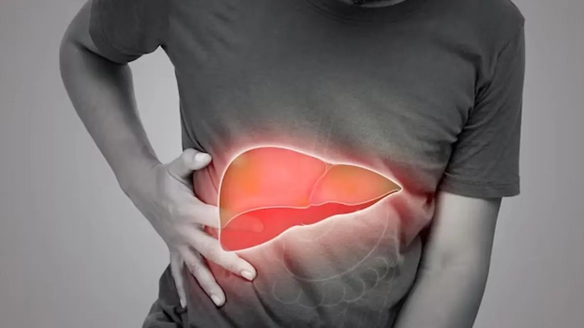 Fatty Liver Disease: A Foot-Related Symptom That May Indicate Advanced, Irreversible Damage