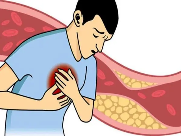 Age 46-55 is 'high ri.sk period in life': 10 signs in people prone to str.o.ke, 'early de.a.th'