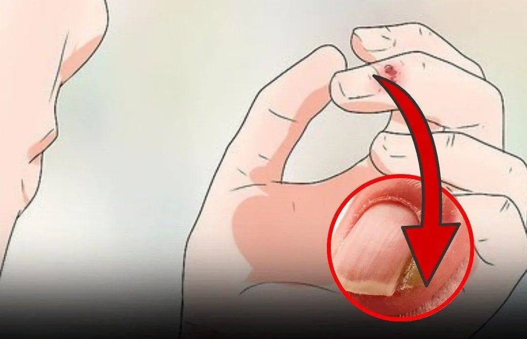 Suffering from Canker Sores? Here Are 3 Powerful Home Treatments You Should Try