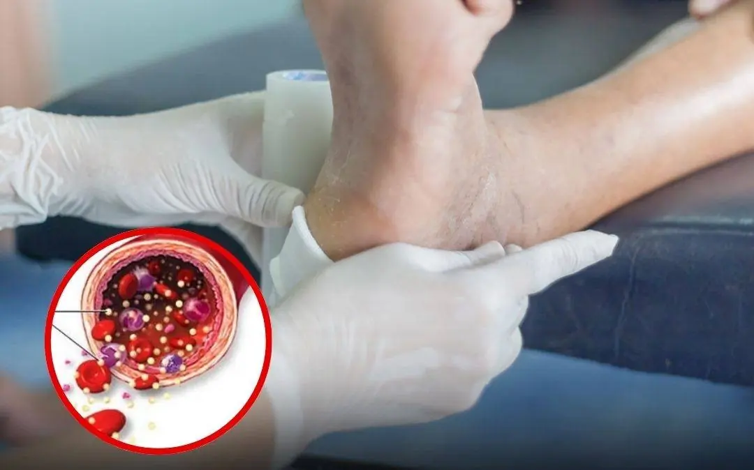 Too many people with irregular bl.o.od sugar levels don’t notice the signals their bodies give!