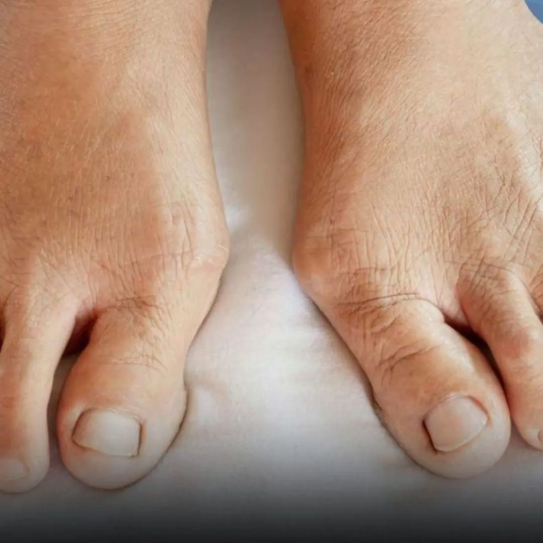 To know if your internal org.ans are infected, just look at your feet. If there are 3 signs, you need to go to the emergency room