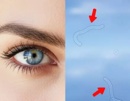 What Are Eye Floaters? Here What To Do If you Start Seeing Them, According to an Eye Doctor