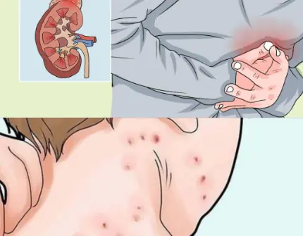 Early Signs of Kidney Disease & How to Protect Your Kidneys (Evidence Based)