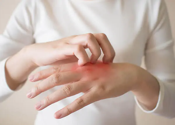 It.ching in 9 areas of the body: When it could be a warning sign of serious ill.ness