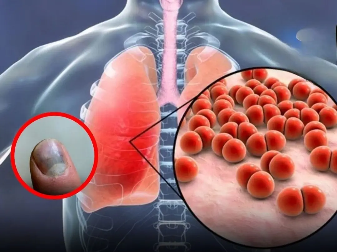 Your Hands Might Be Exposing Serious Lu.ng Trouble Without You Realizing It