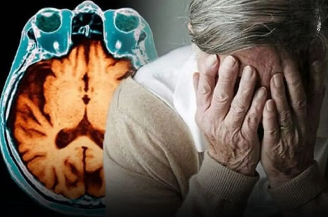 Roughly 15 minutes before a str.ok.e strikes, the body often sends out 4 unmistakable war.ning signs