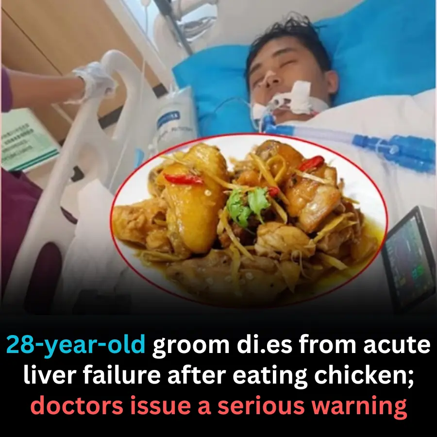 28-Year-Old Groom Dies from Acute Liver Failure: Doctors Warn About a Dangerous Eating Habit Involving Chicken