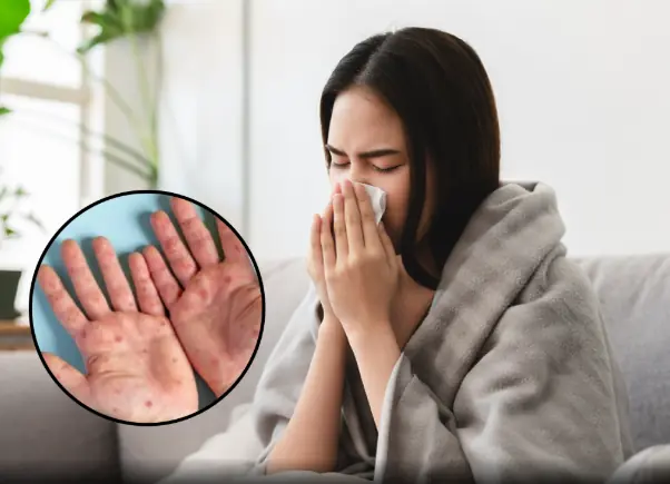 People With HIV Explain The First Symptoms They Noticed As Experts Warn Of 3.3 Million New Cases