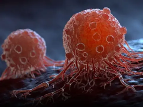 Discover 20 signs of cancer that most women ignore