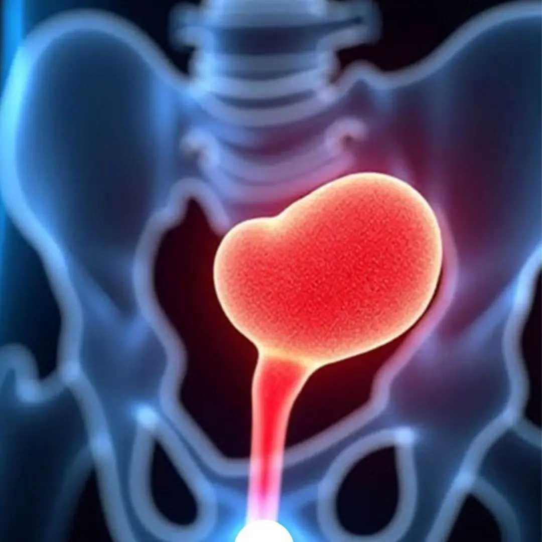 Men Who Neglect This Crucial Practice Face 45% Higher Risk of Prostate Cancer