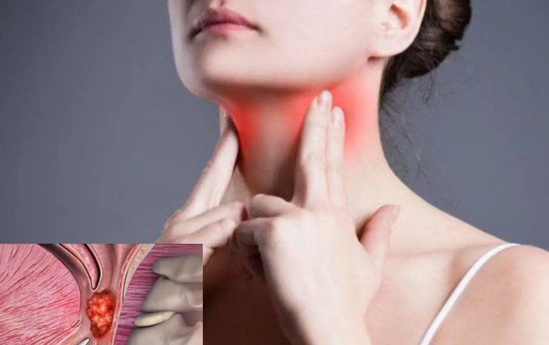 See this sign on bo:dy, you should go to the hospital imme:diately!