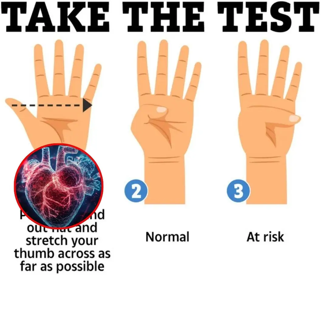Doctor reveals simple thumb test that can detect he.a.rt problems like 'ticking time b.o.m.b'