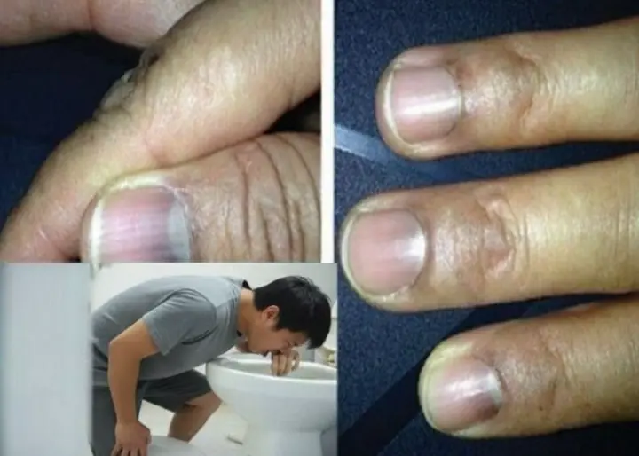 7 signs of can.cer that can appear in the morning