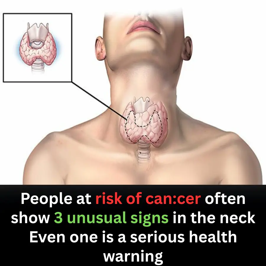3 Unusual Neck Signs That May Signal Can.cer Risk — Doctors Urge Early Checkups