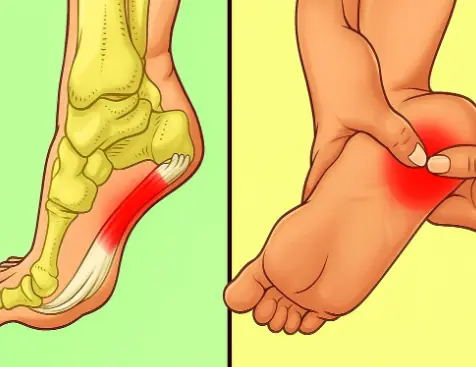 7 Powerful Exercises to Relieve Heel Pain and Treat Plantar Fasciitis Naturally