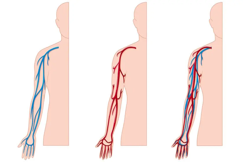 Someone with bulging v.e.i.ns