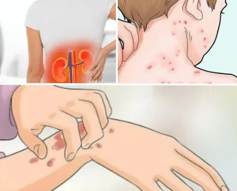 If Your Kidneys Are in Danger, the Body Will Show these 10 Signs