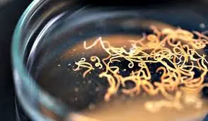 Man develops 'pork worms' in his brain after years doing this specific cooking habit