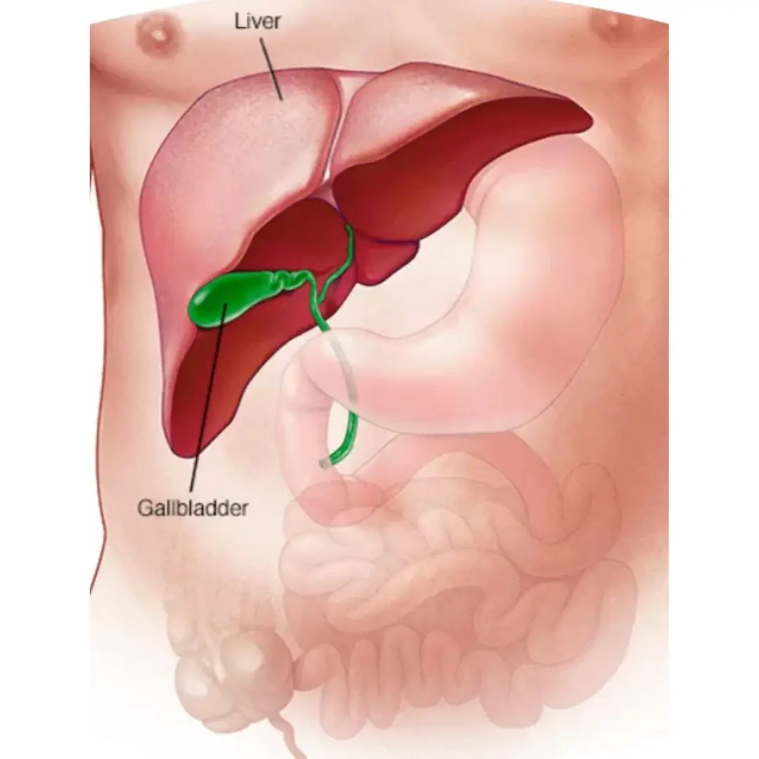 Gallbladder removal: what happens next and 3 risks to watch for