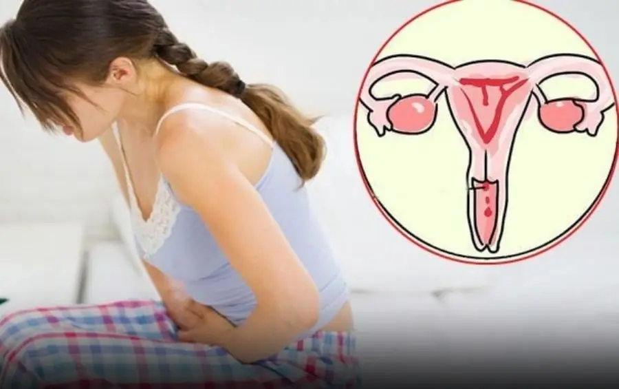 Cervical can:cer is one of the most common can:cers in women worldwide. If detected early, it can be treated effectively.