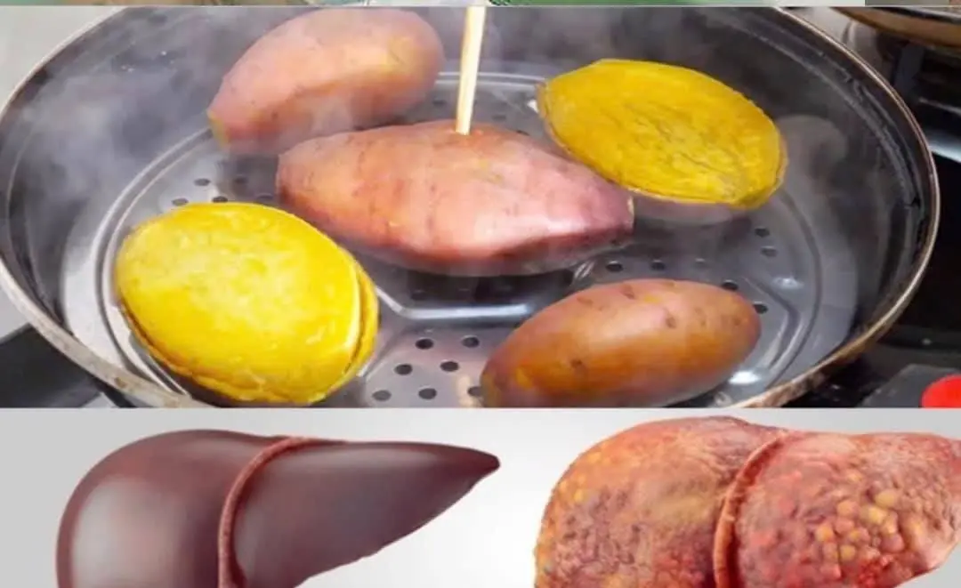 Eating steamed sweet potatoes every day, woman panicked when receiving liver test results