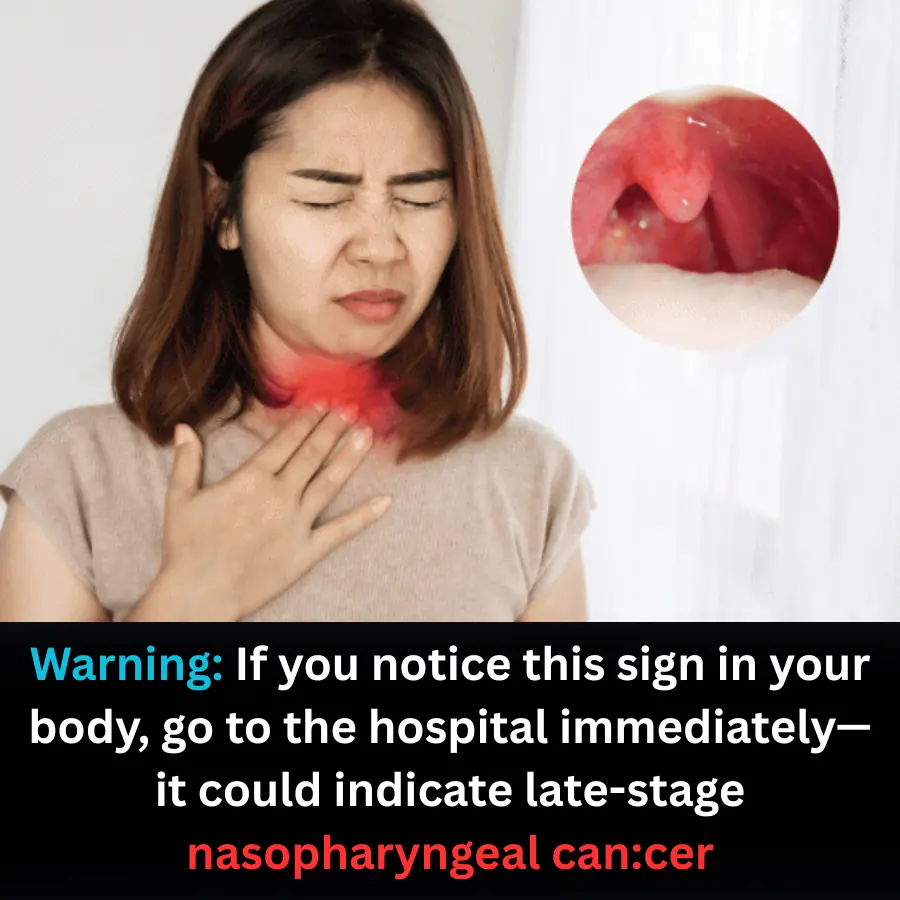 Warning Signs of Late-Stage Nasopharyngeal Cancer You Should Never Ignore