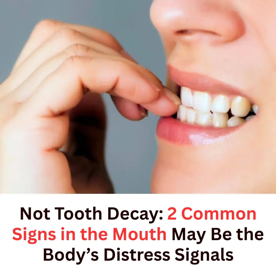 Not Tooth Decay: Two Oral Signs That Could Be Your Body’s Cry for Help