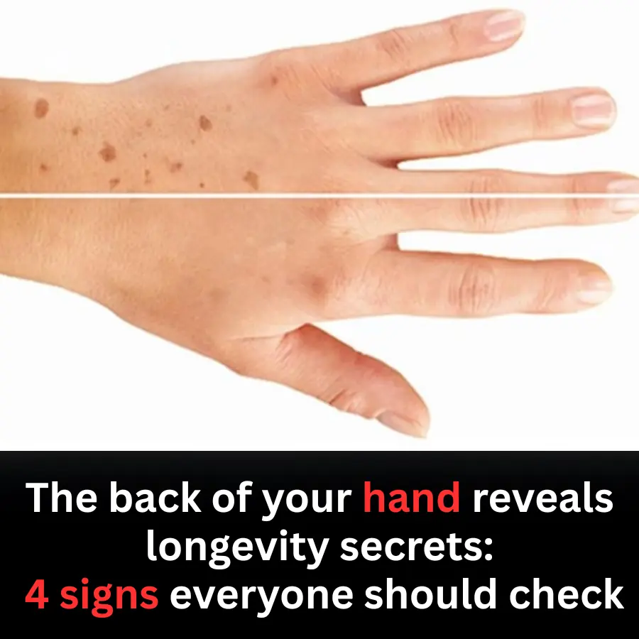 The Back of Your Hand May Reveal Longevity Secrets: 4 Signs Everyone Should Check