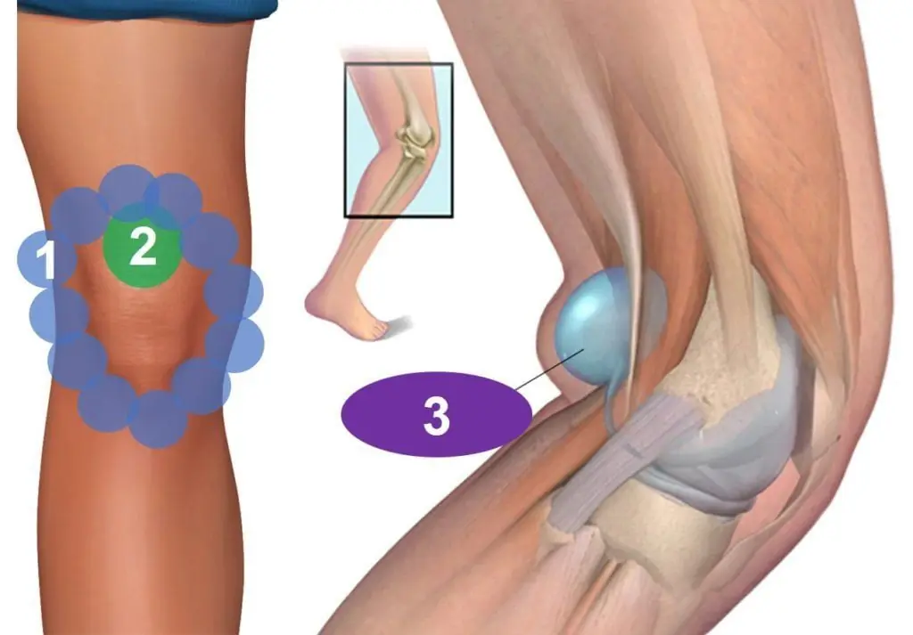 Muscle pain behind the knee, a dan.gerous symptom that should not be ignored