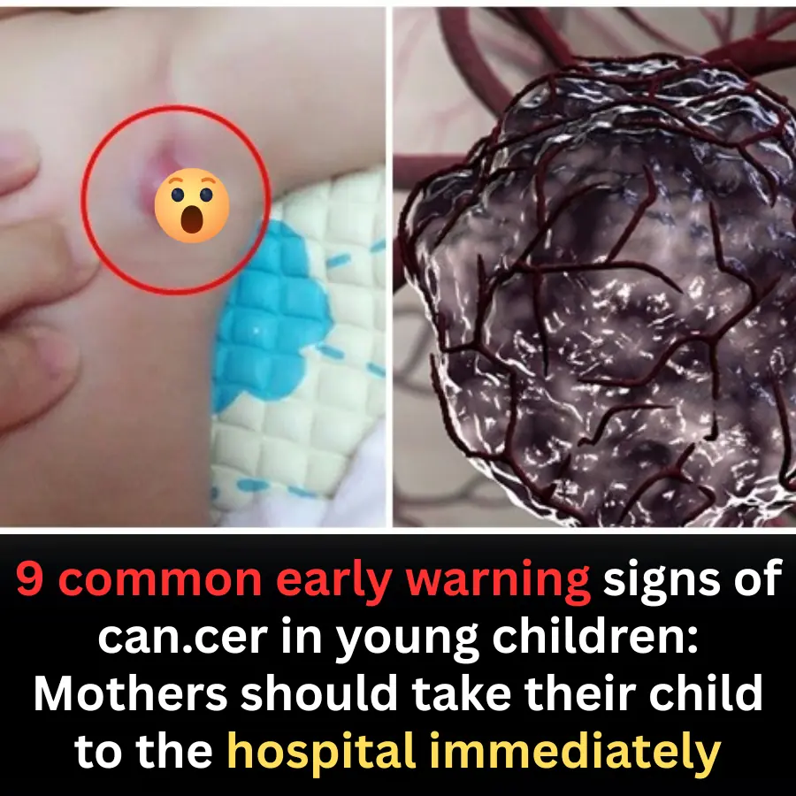 9 Common Early Warning Signs of Cancer in Young Children Parents Must Never Ignore